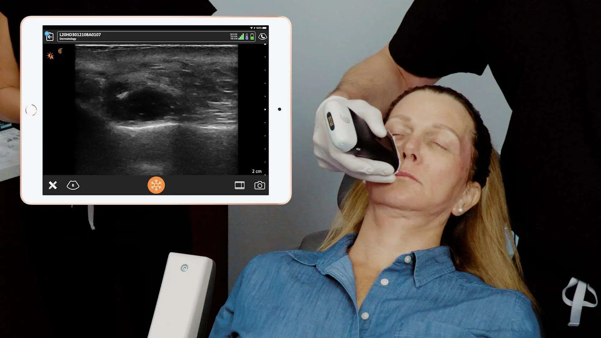 Ultrasound machine at Aesthetic Center of Richmond Dermatology in Glen Allen, VA